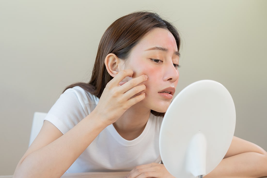 Skin-Type---Sensitive-Skin